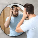 Waktu terbaik melakukan hair transplant