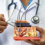Berapa biaya per helai di klinik tanam rambut jakarta