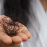 Penyebab rambut rontok
