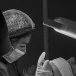 Teknologi Hair Transplant di Jakarta Makin Presisi, Ini Faktanya