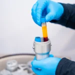 Hair Transplant Jakarta dan PRP, Kenapa Sering Dikombinasikan?