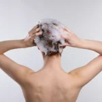 Rambut Rontok Terus Padahal Baru Keramas? Ini Penyebabnya