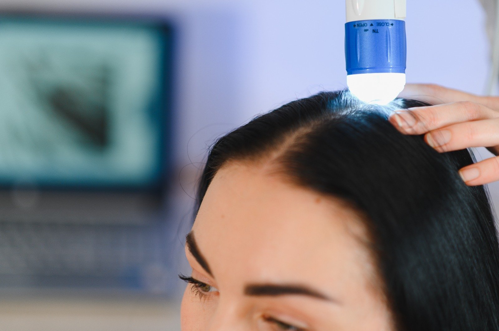 Derma Root Reviews Dermaroot Care - KAI Hair Clinic