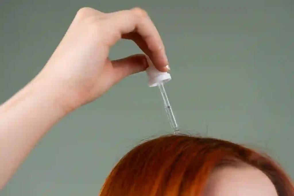 perawatan rambut prp, stem cell, dan exosome