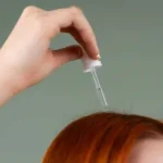 perawatan rambut prp, stem cell, dan exosome